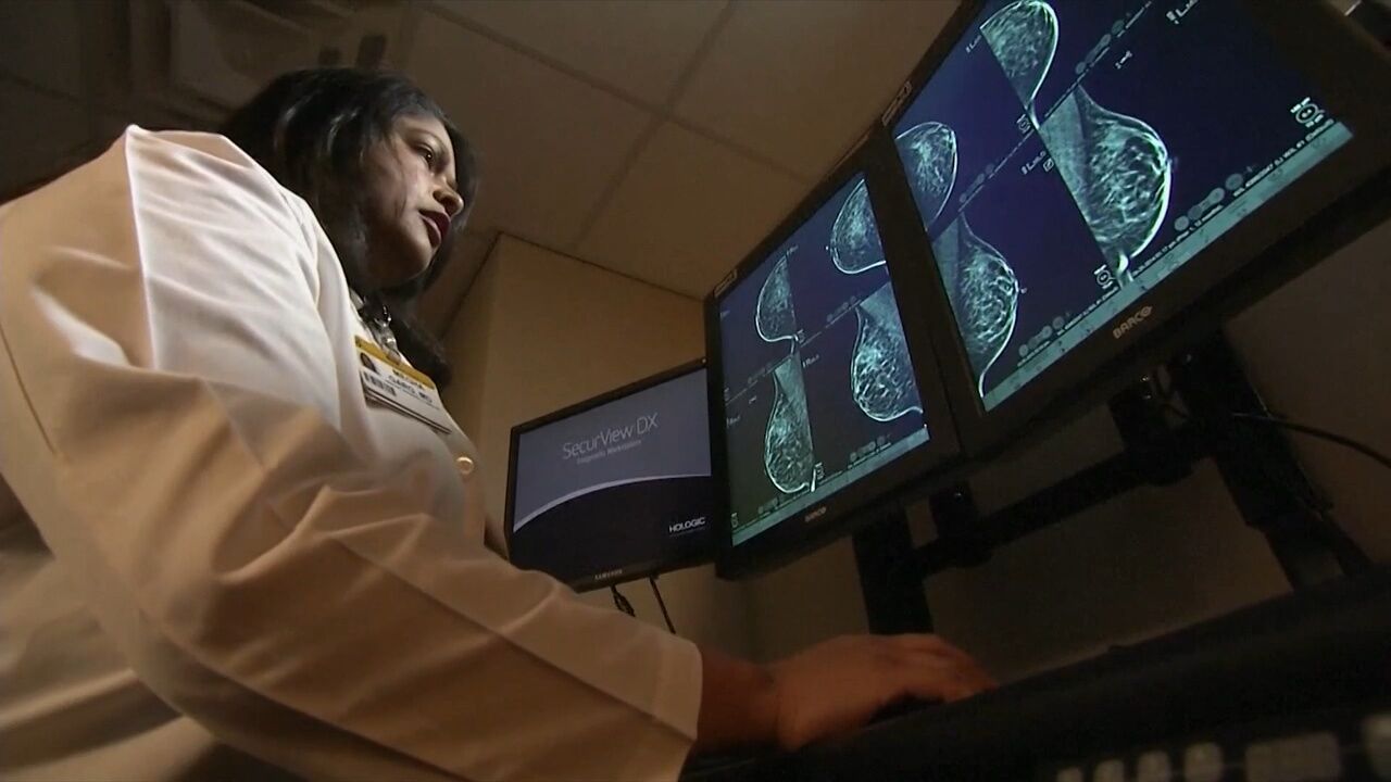 Fewer women are getting screened for breast cancer since pandemic